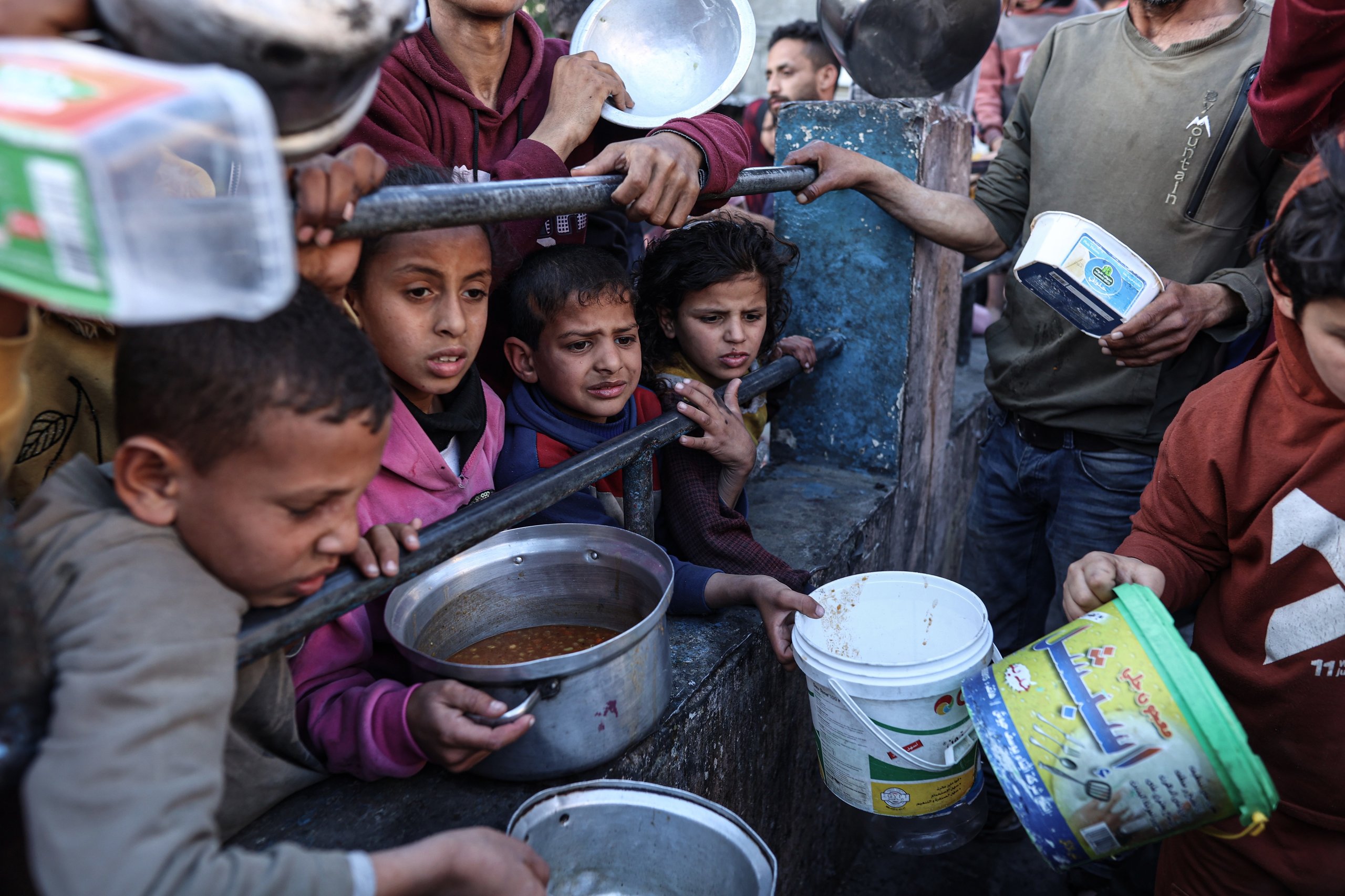 Children in Gaza suffering from severe malnutrition during famine