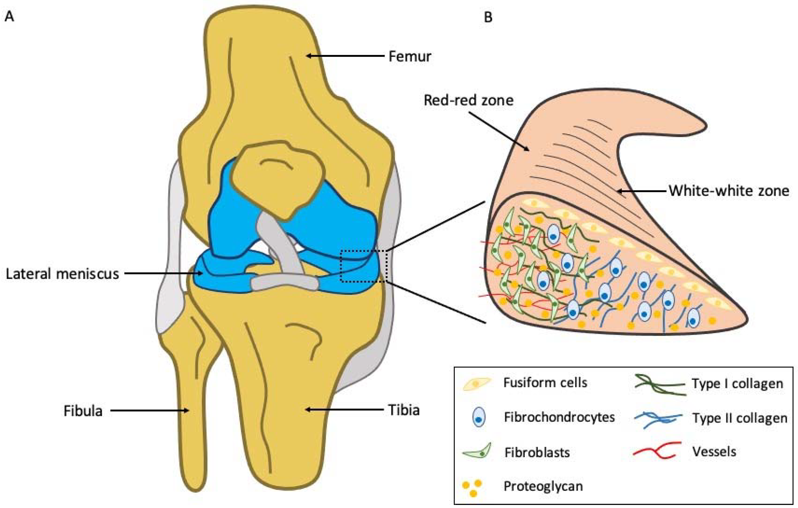 3D printed living knee joint scaffold using stem cells