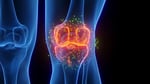 ARPA-H osteoarthritis breakthrough showing cartilage and bone regeneration in knee joint