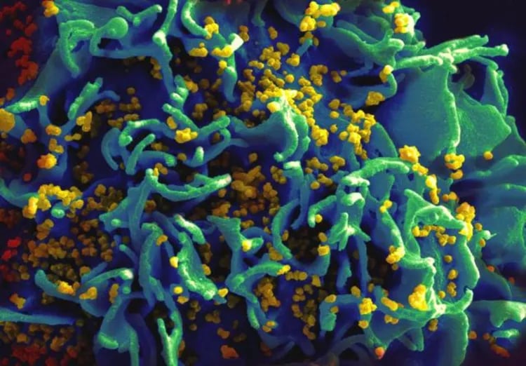 Microscopic view of HIV virus particles in the human body