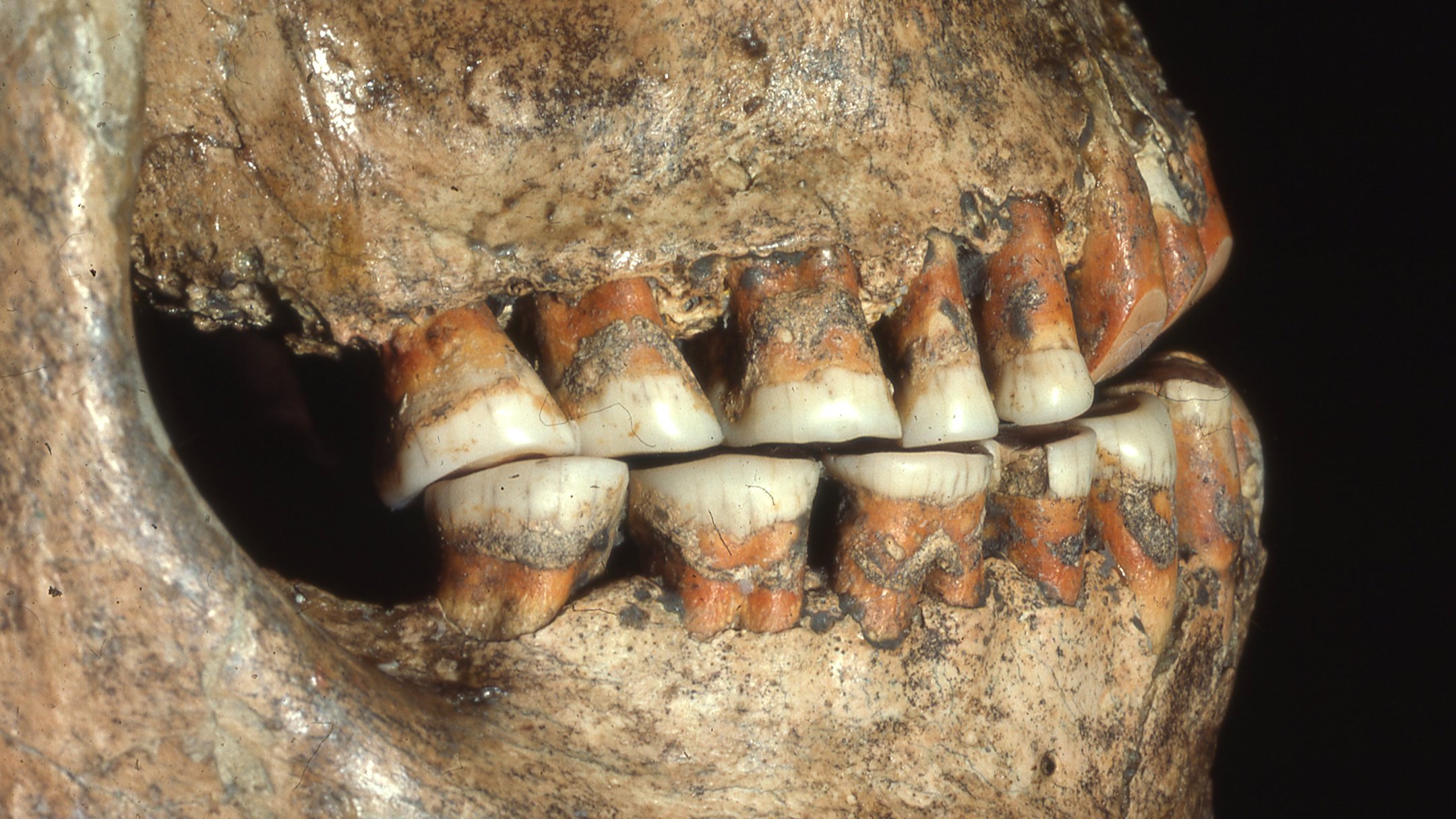 Fossilized Neanderthal teeth used for mitochondrial DNA analysis